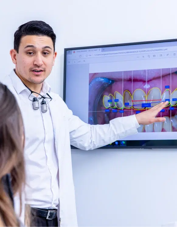 3D Smile Simulation
