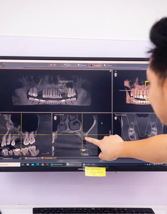 Root Canal Treatment