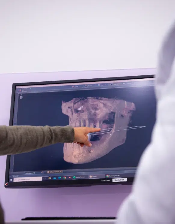 Wisdom Teeth Extraction