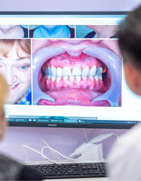 Laser Gum Treatment