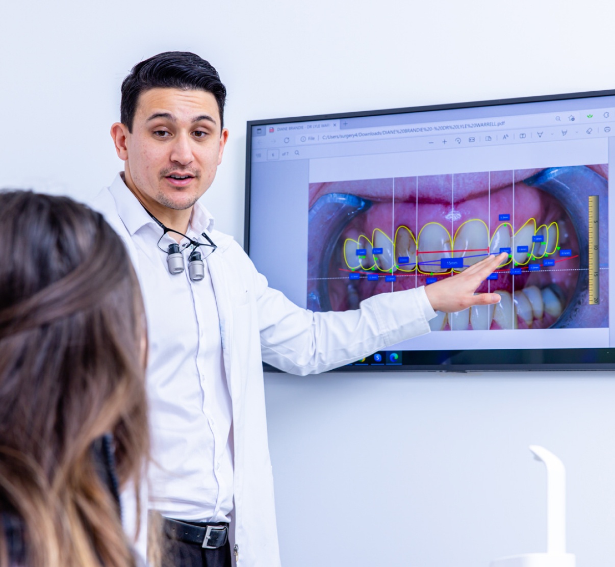 Digital Smile Design - Mobile