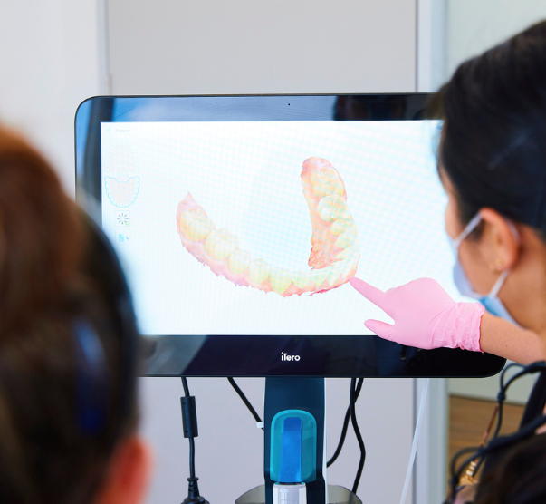 Intraoral Camera In Sunbury Dentist